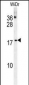 CHCHD2 Antibody (Center)